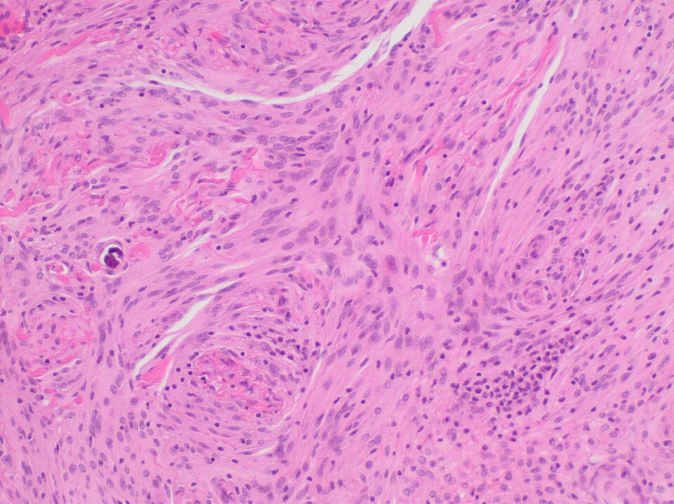 H&E-stained histopathology slide, 40x, AI-annotated