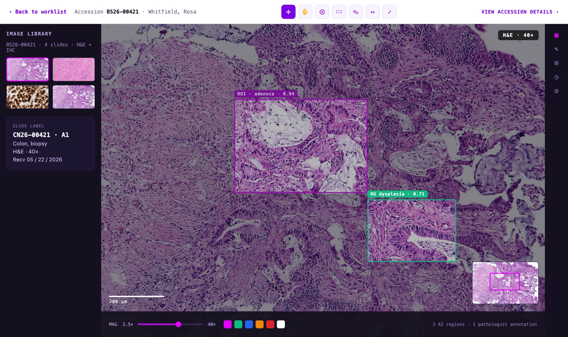 FlexLIS IMS viewer — AI regions of interest flagged on a whole-slide image