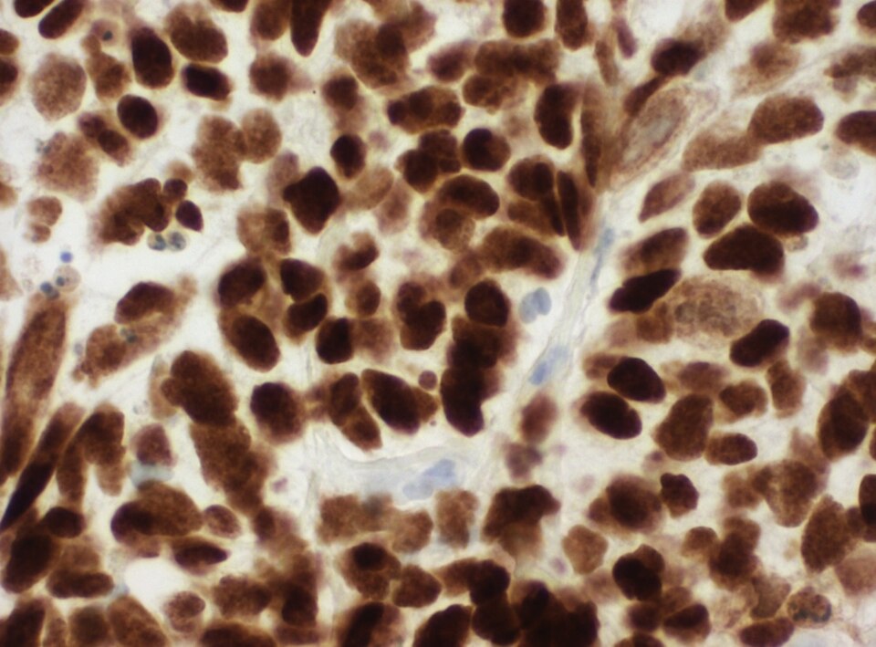 p63 immunohistochemistry at 40x